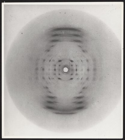DNA X-ray diffraction image known as Photo 51, Annotated by Rosalind ...